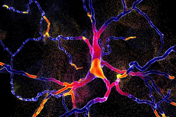 Parkinson's Disease Parkinson's Disease